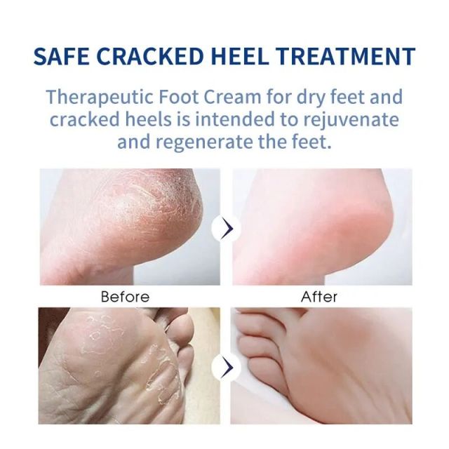 Snail Dry Damaged Skin Repair Moisturizing Foot Cream
