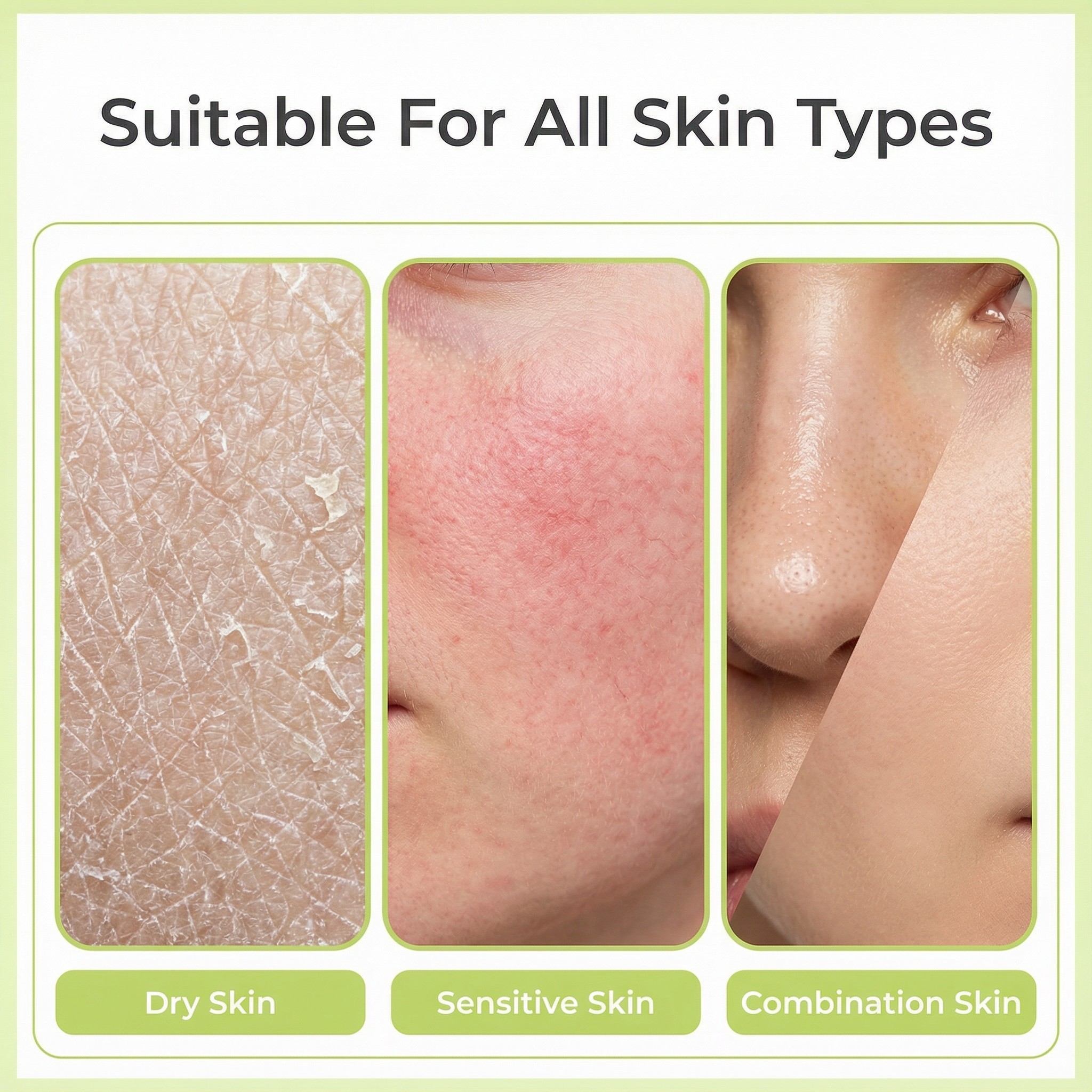 Skin suitability chart for PURAMORIA facial cleanser, validating safety and effectiveness for Dry Skin flakiness, Sensitive Skin redness (rosacea-prone), and Combination Skin oily nose pores. Safe everyday cleanser for compromised skin.