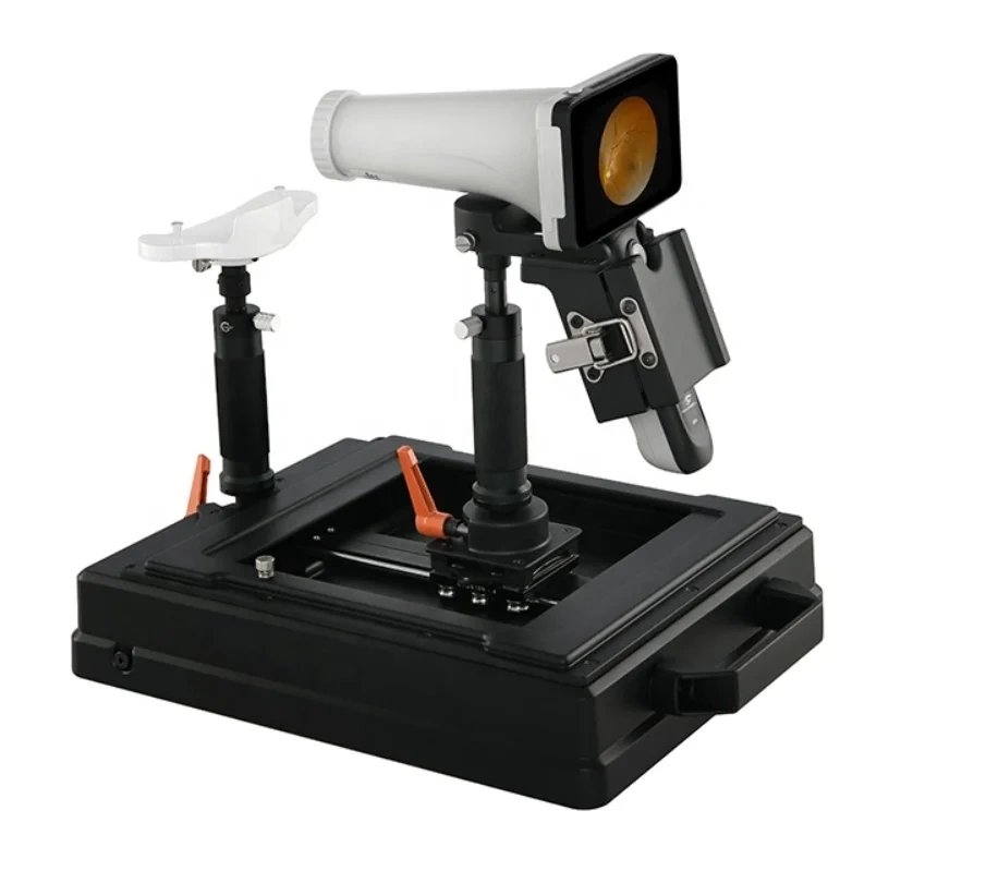 Portable Fundus Camera CFC-X Handheld Eye Fundus Retinal Camera Non-Mydriatic Digital Fundus Camera Ophthalmic Instrument