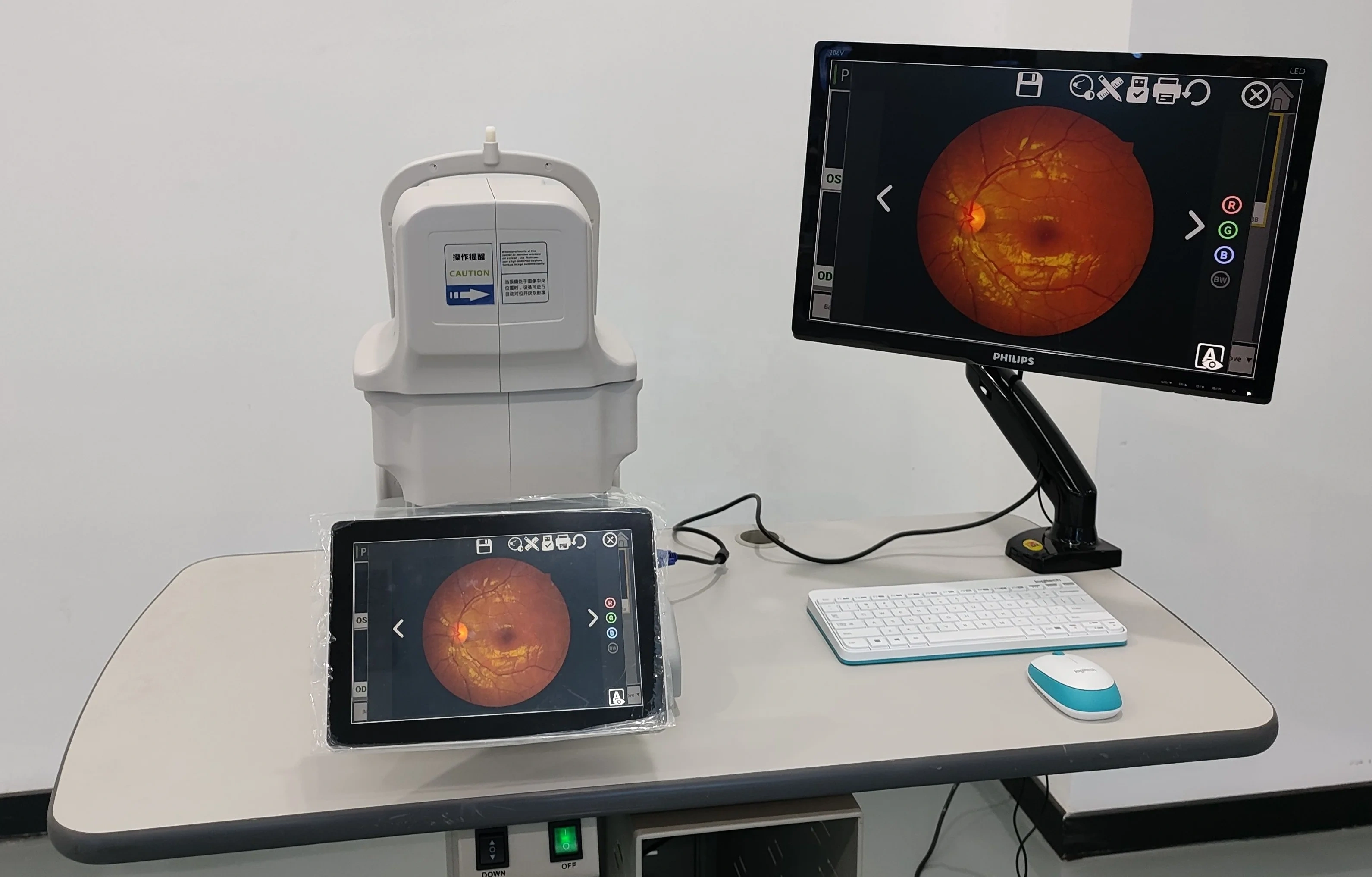 Auto Fundus Camera Kestrel 3100m China Ophthalmic Auto Digital Eye Fundus Retinal Camera with Built-in Computer