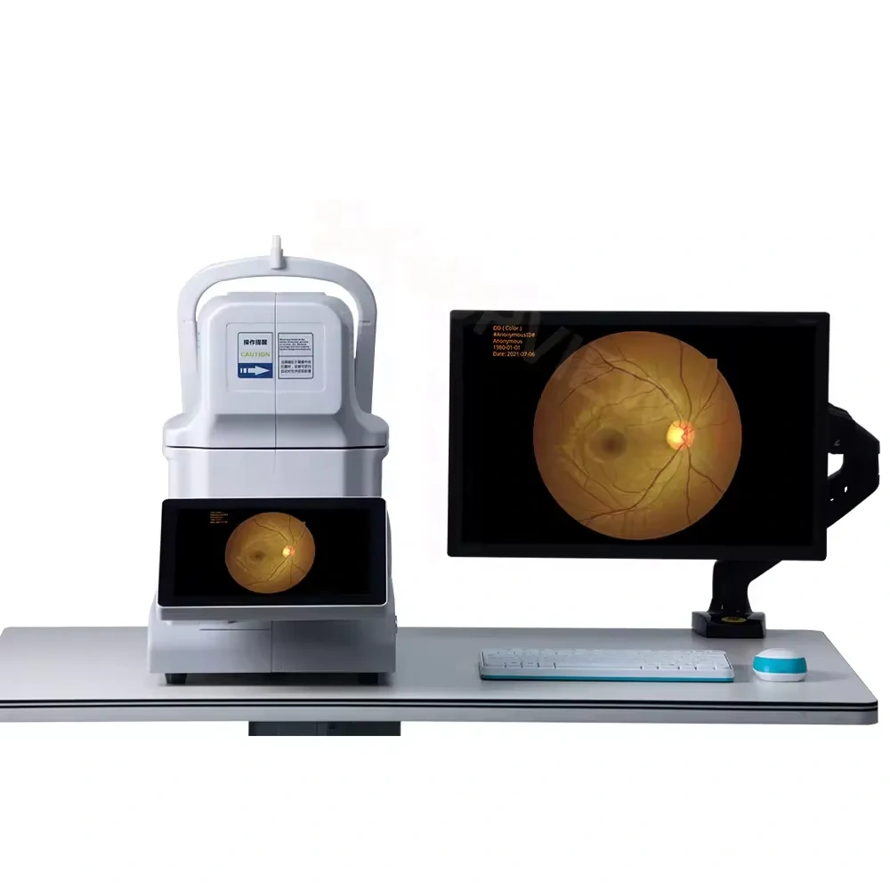 Auto Fundus Camera Kestrel 3100m China Ophthalmic Auto Digital Eye Fundus Retinal Camera with Built-in Computer