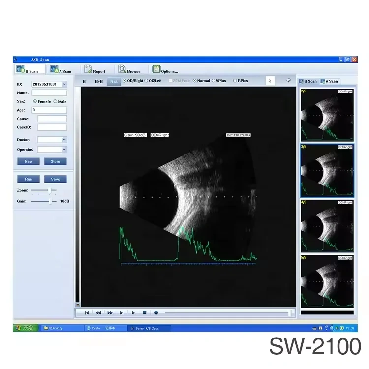 SW-2100 Ophthalmic A/B Scan Ophthalmic Ultrasound AB Scanner Pachymeter Biometer