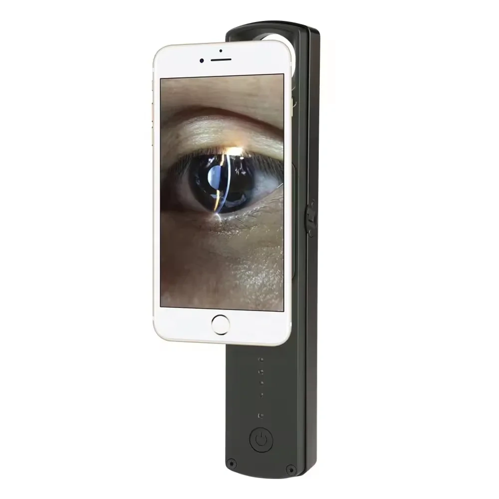 S150 Portable Slit Lamp Ophthalmology Equipment Eye Exam Pen style Ultra Mini Smart Handheld Slit Lamp microscope