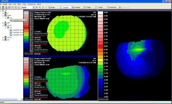 SW-6000 Ophthalmic Corneal Topography Equipment Eye Optical Optomery Corneal Topographer