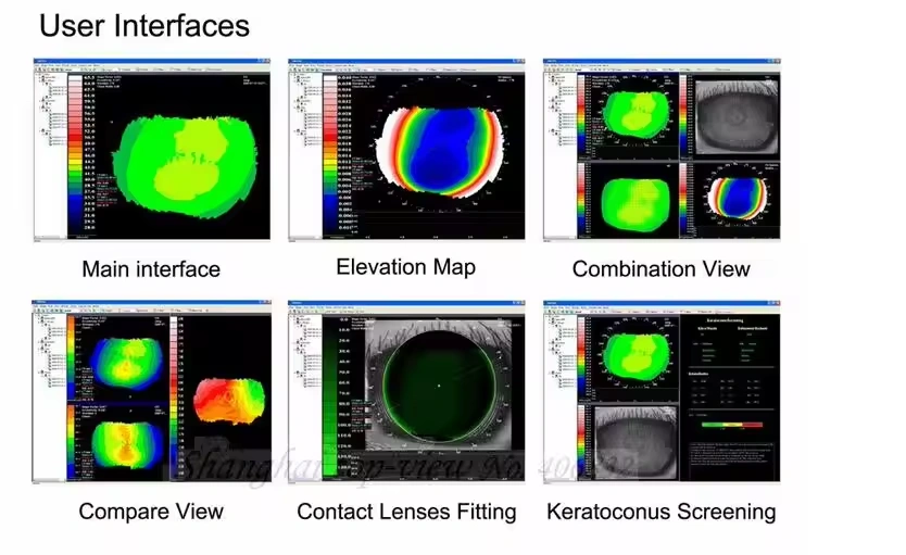 SW-6000 Ophthalmic Corneal Topography Equipment Eye Optical Optomery Corneal Topographer