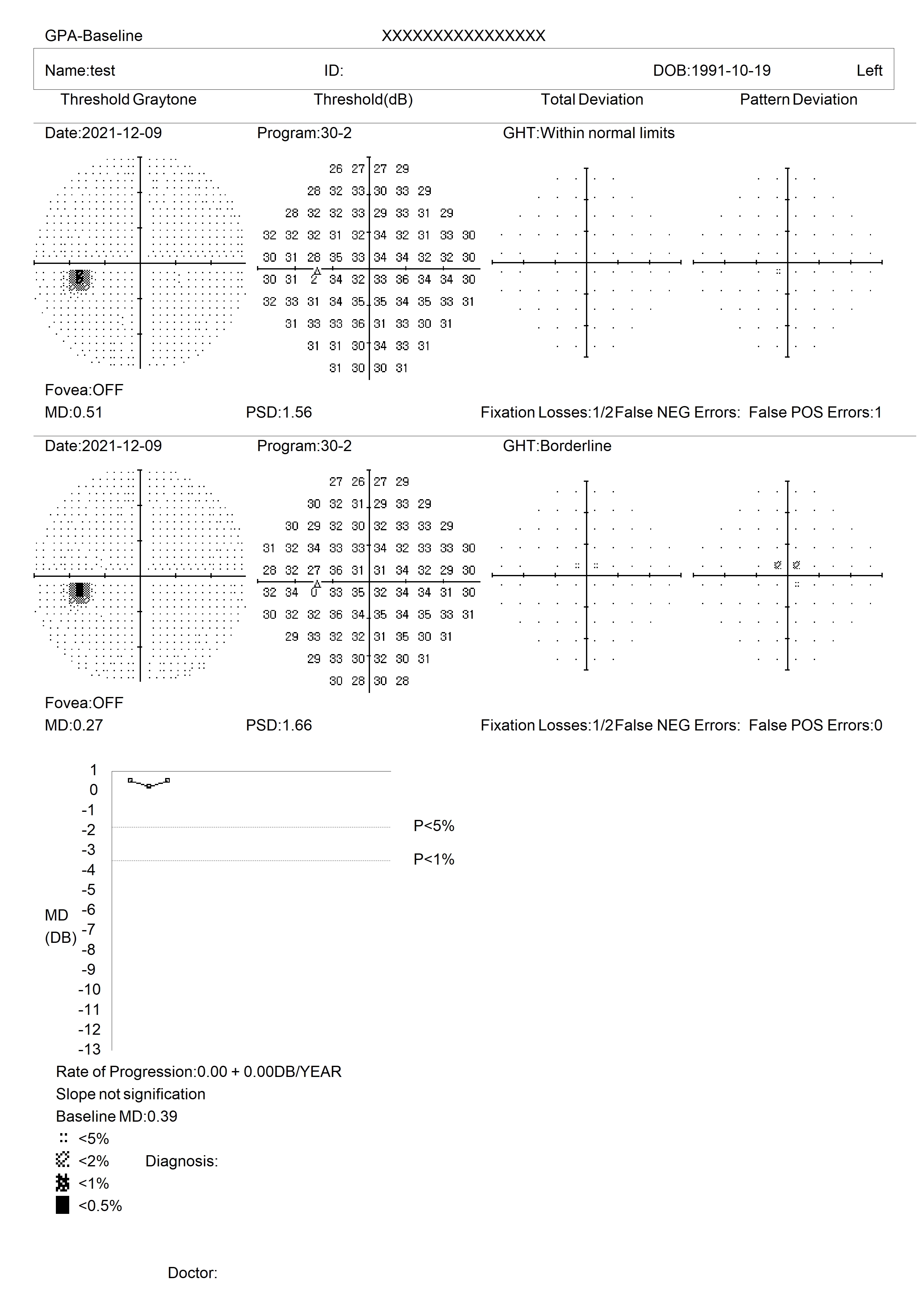 SVF-7000 Ophthalmology Eye Field Test Machine Automatic Visual Field Analyzer Projection Perimeter