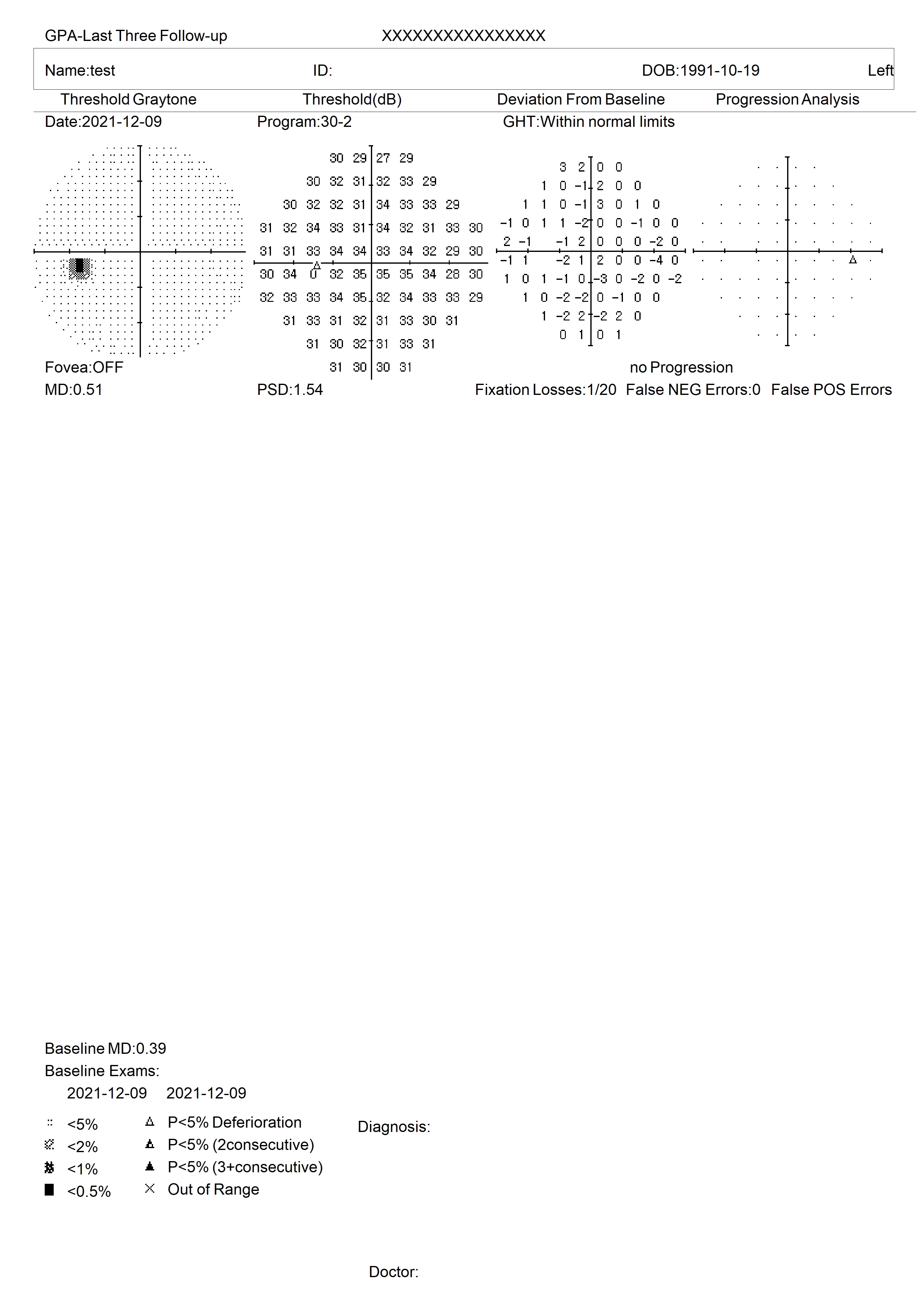 SVF-7000 Ophthalmology Eye Field Test Machine Automatic Visual Field Analyzer Projection Perimeter