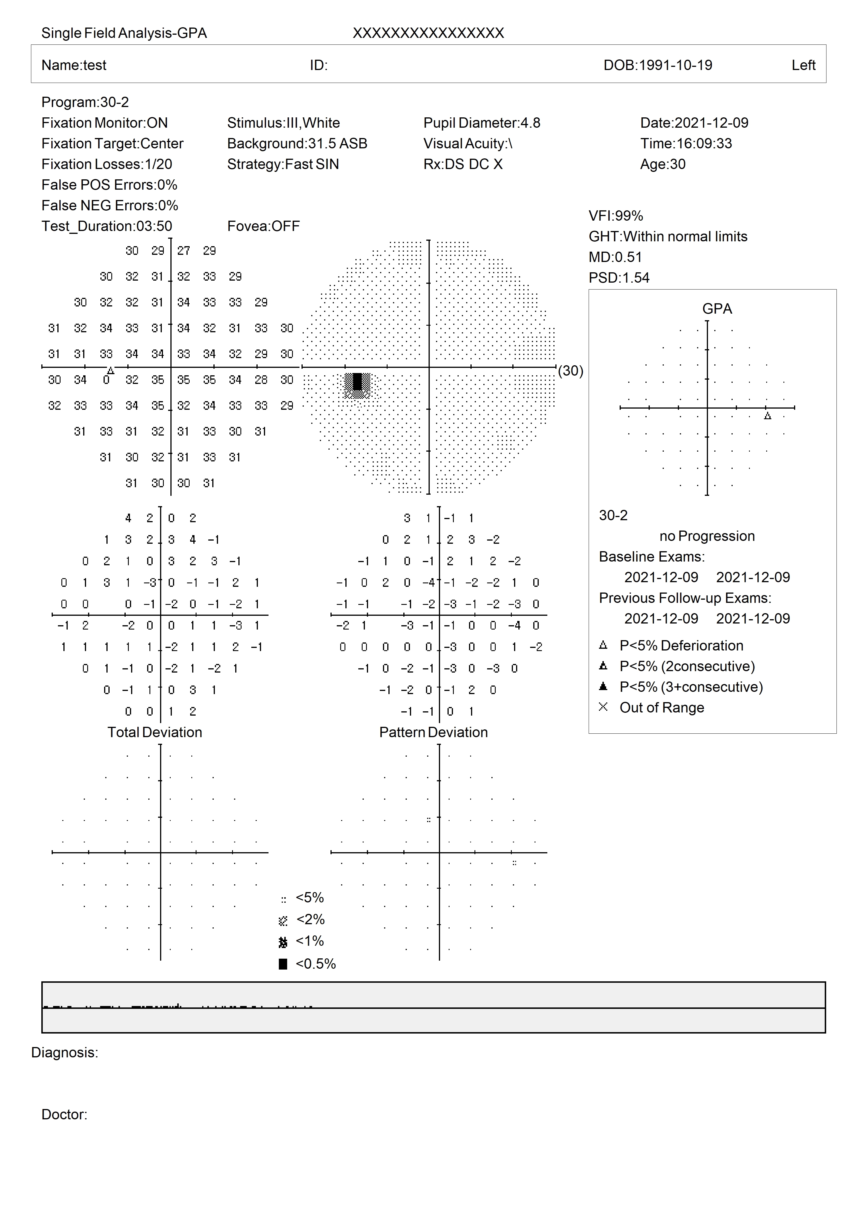 SVF-7000 Ophthalmology Eye Field Test Machine Automatic Visual Field Analyzer Projection Perimeter