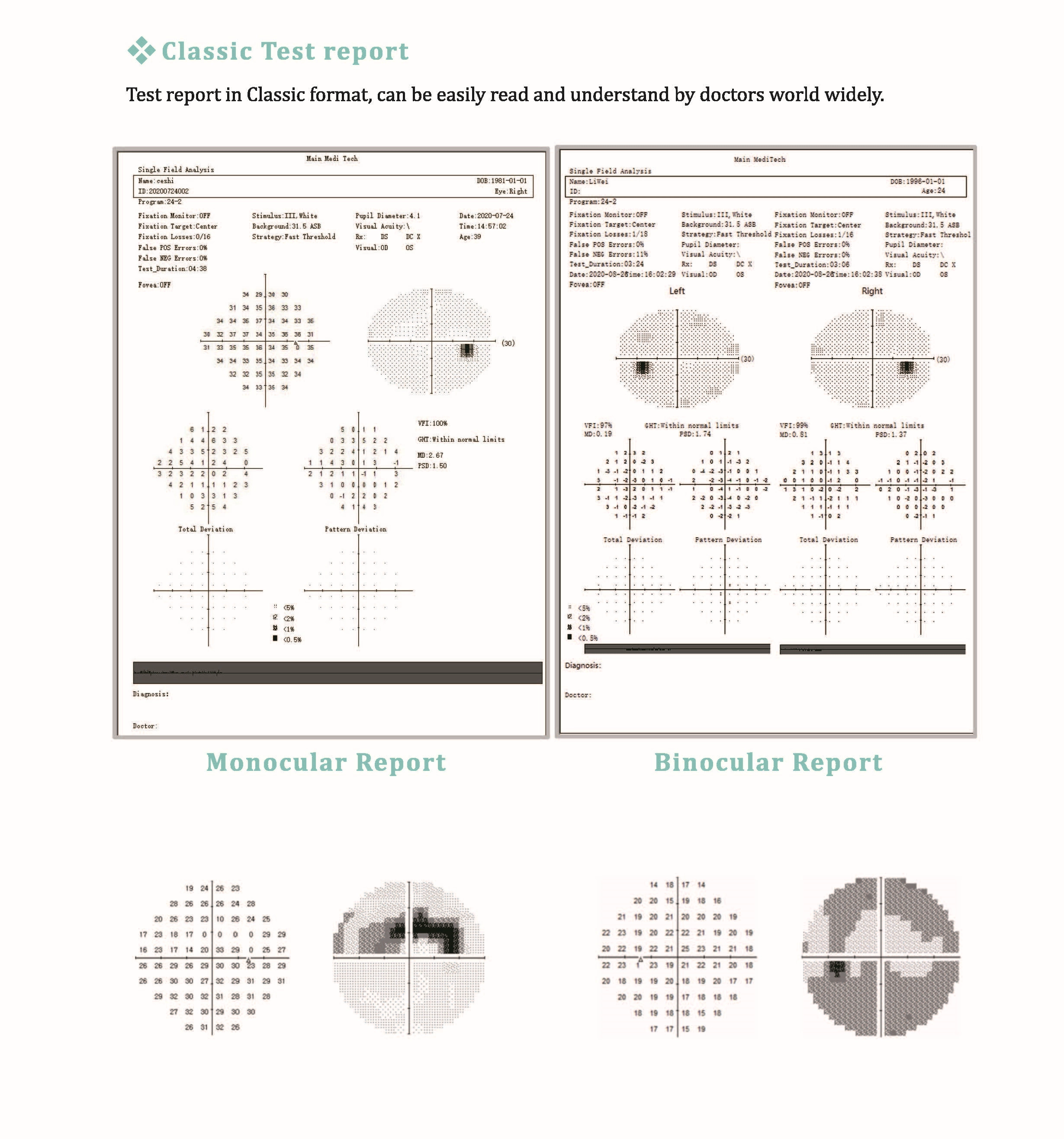 SVF-7000 Ophthalmology Eye Field Test Machine Automatic Visual Field Analyzer Projection Perimeter