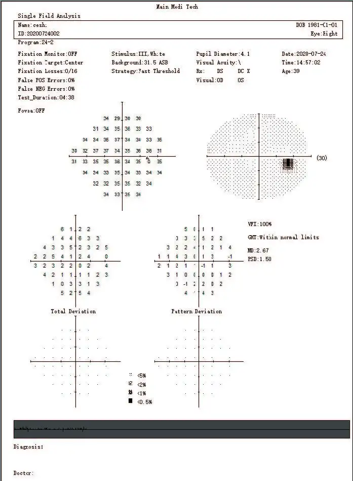 SVF-7000 Ophthalmology Eye Field Test Machine Automatic Visual Field Analyzer Projection Perimeter