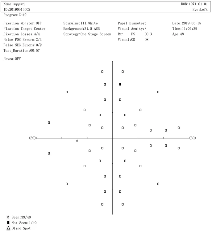 Cheapest New Style Projection Perimeter Fully Auto Perimeter BIO1000 Visual Field Analyzer