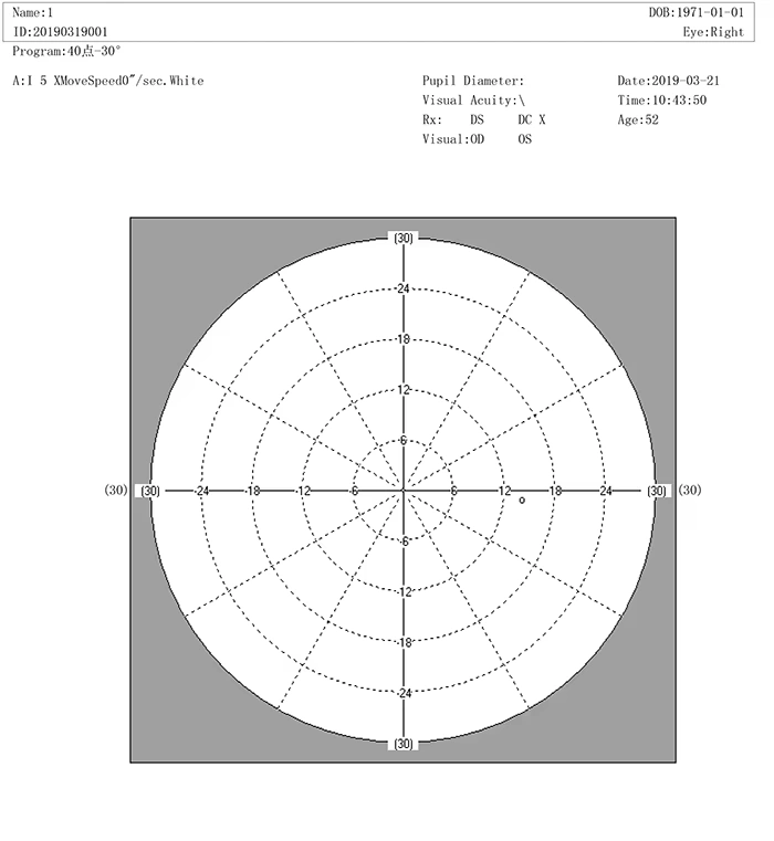 Cheapest New Style Projection Perimeter Fully Auto Perimeter BIO1000 Visual Field Analyzer