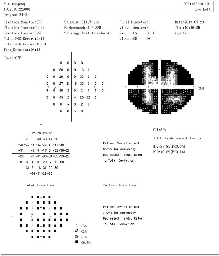 Cheapest New Style Projection Perimeter Fully Auto Perimeter BIO1000 Visual Field Analyzer