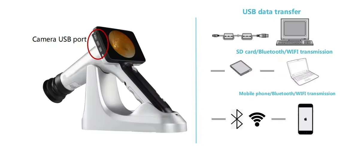 Portable Fundus Camera CFC-X Handheld Eye Fundus Retinal Camera Non-Mydriatic Digital Fundus Camera Ophthalmic Instrument