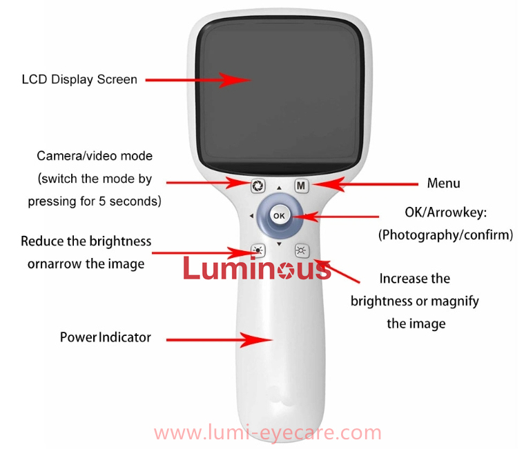 Portable Fundus Camera Optics Equipment Handheld Fundus Camera Retina Camera Handheld High definition Imaging NES-1000
