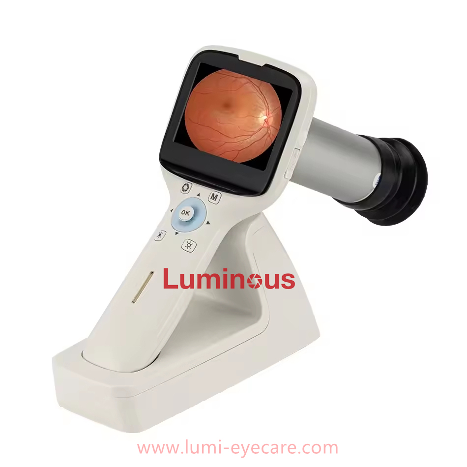Portable Fundus Camera Optics Equipment Handheld Fundus Camera Retina Camera Handheld High definition Imaging NES-1000