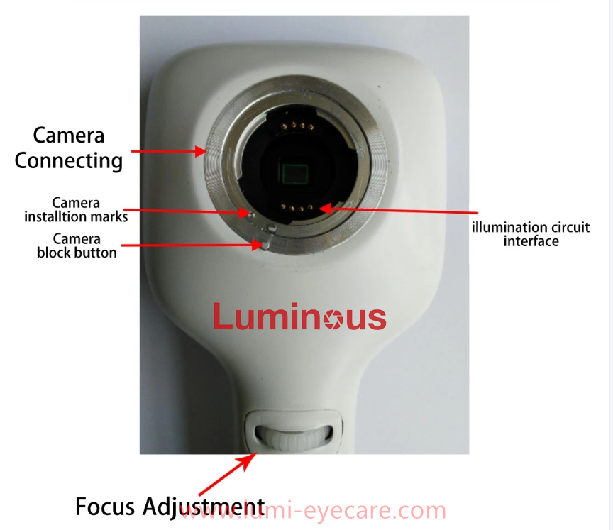 Portable Fundus Camera Optics Equipment Handheld Fundus Camera Retina Camera Handheld High definition Imaging NES-1000