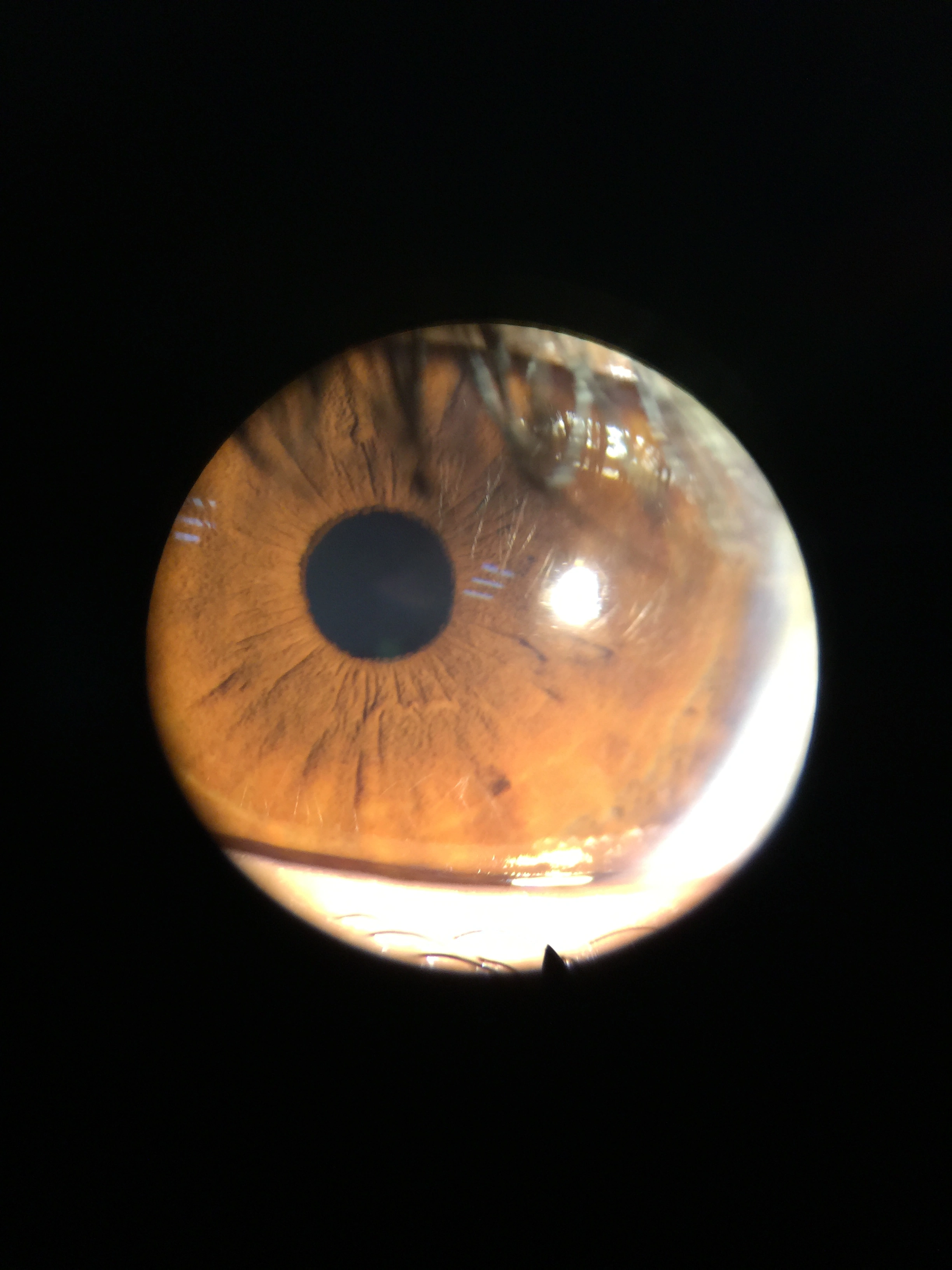 Digital Eyepiece Adapter for Slit lamp Adapter connect with Phone Connection Mobile Phone Adapter for Portable slit lamp