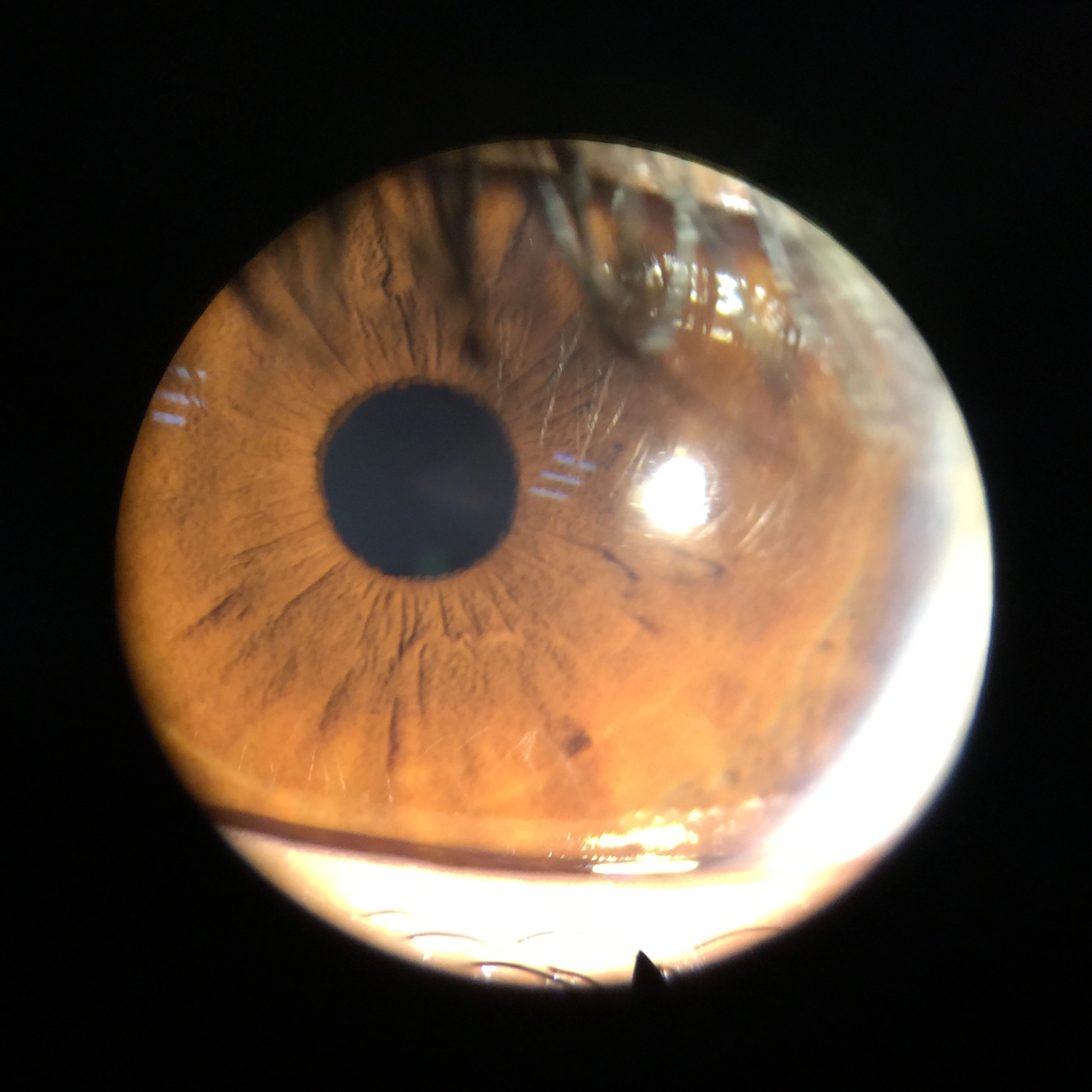 Digital Eyepiece Adapter for Slit lamp Adapter connect with Phone Connection Mobile Phone Adapter for Portable slit lamp