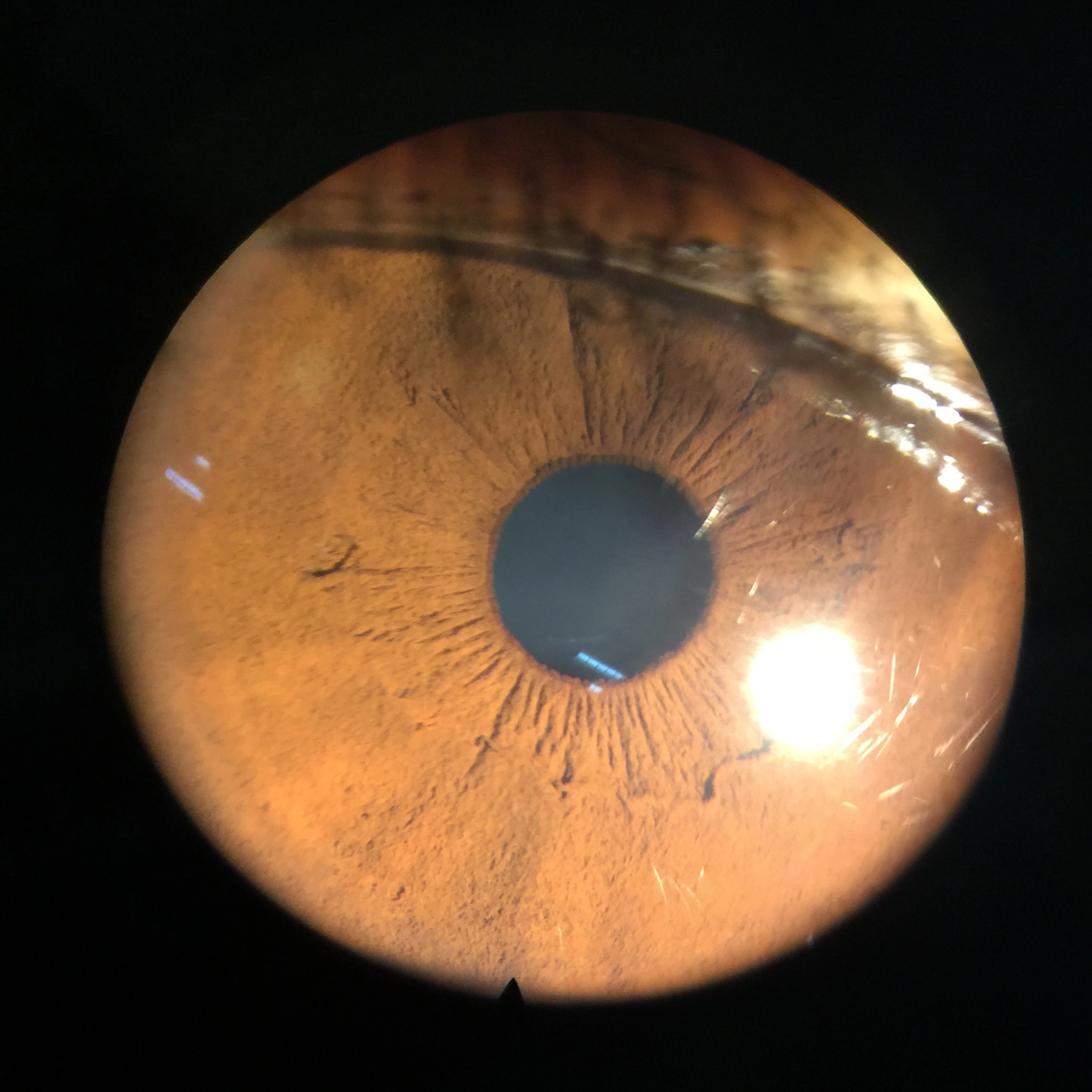 Digital Eyepiece Adapter for Slit lamp Adapter connect with Phone Connection Mobile Phone Adapter for Portable slit lamp