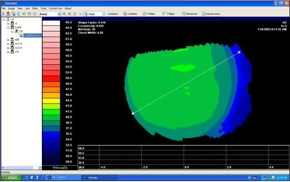 SW-6000 Ophthalmic Corneal Topography Equipment Eye Optical Optomery Corneal Topographer
