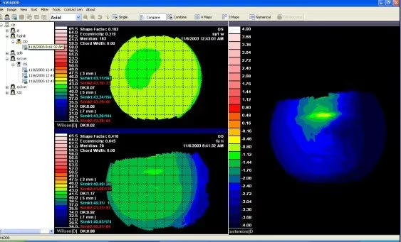 SW-6000 Ophthalmic Corneal Topography Equipment Eye Optical Optomery Corneal Topographer
