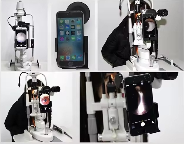 Digital Eyepiece Adapter for Slit lamp Telescope Microscope,Cellphone Adapter connect with Phone Connection,Mobile Phone Adapter for Portable slit lamp