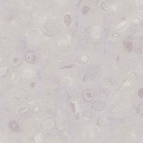 Heterogeneous-Chun Guang Li