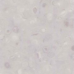 Heterogeneous-Chun Guang Li