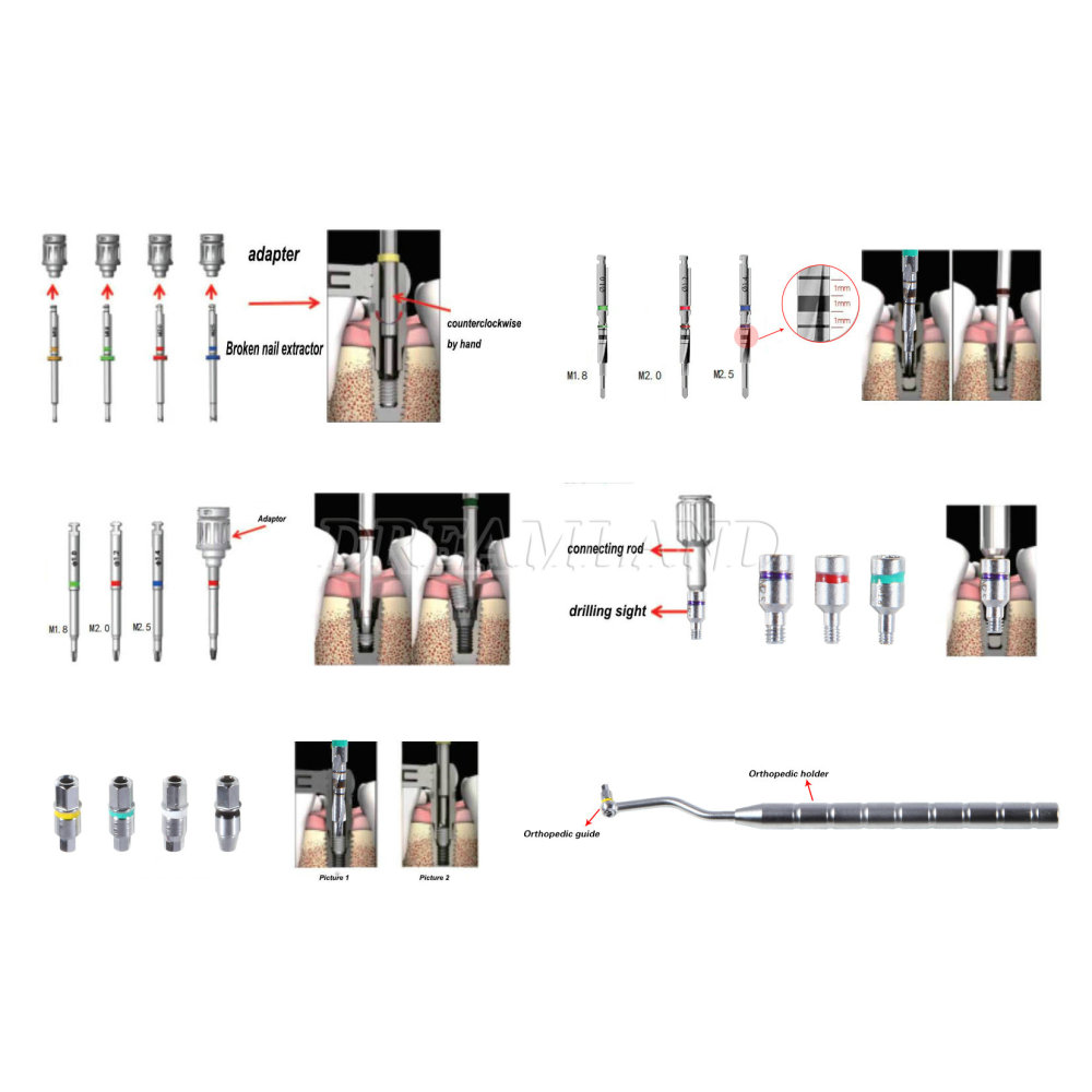 Dental Implant Broken Screw Remover Kit Reverse Drill Guide Driver