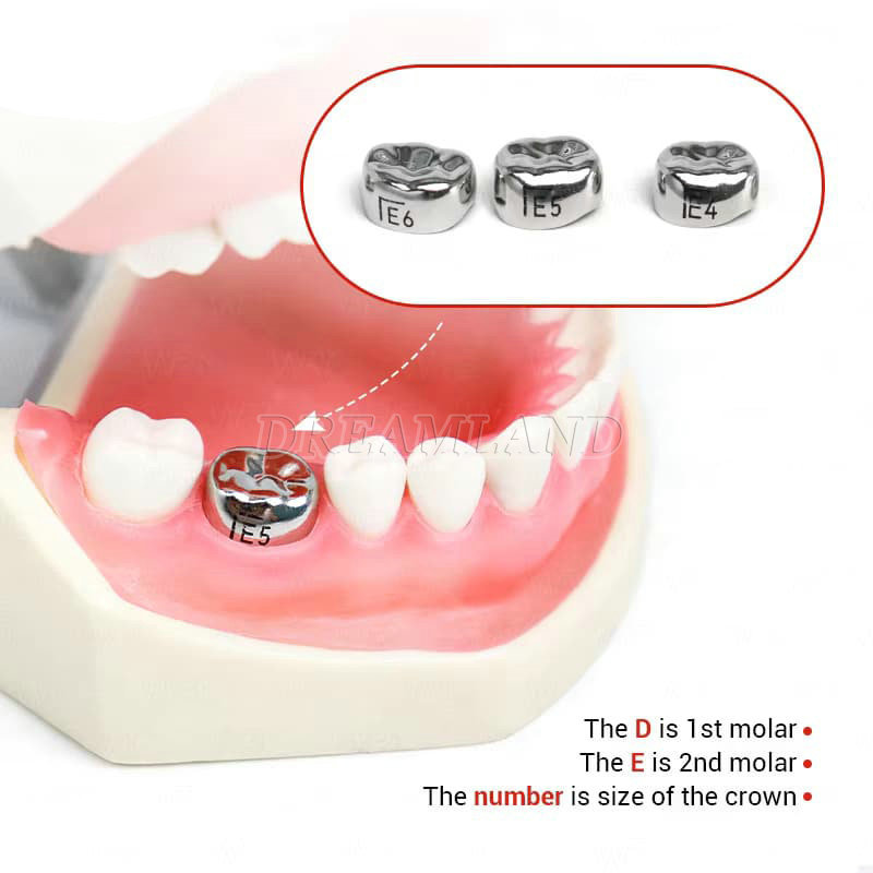 Dental Kids Primary Molar Crown Stainless Steel Pediatric Preformed Crown Set