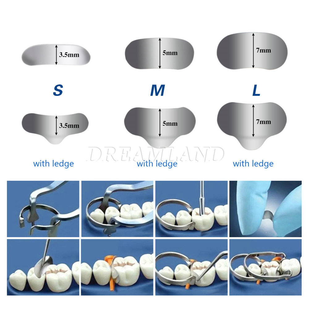 50Pcs Dental Metal Matrices Matrix Band Sectional Contoured Refill S/M/L 35μm