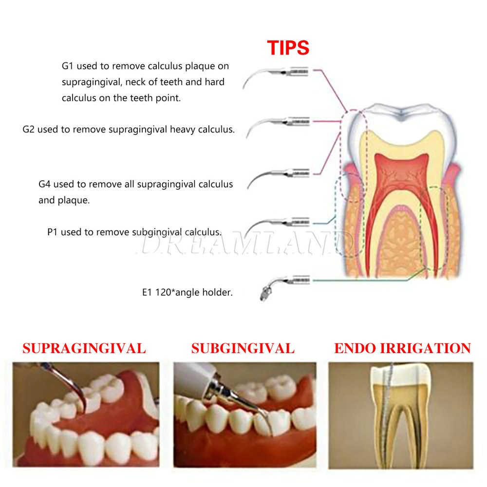 Dental Ultrasonic Scaler Scaling Perio Endo with LED Detachable Handpiece fit EMS Woodpecker