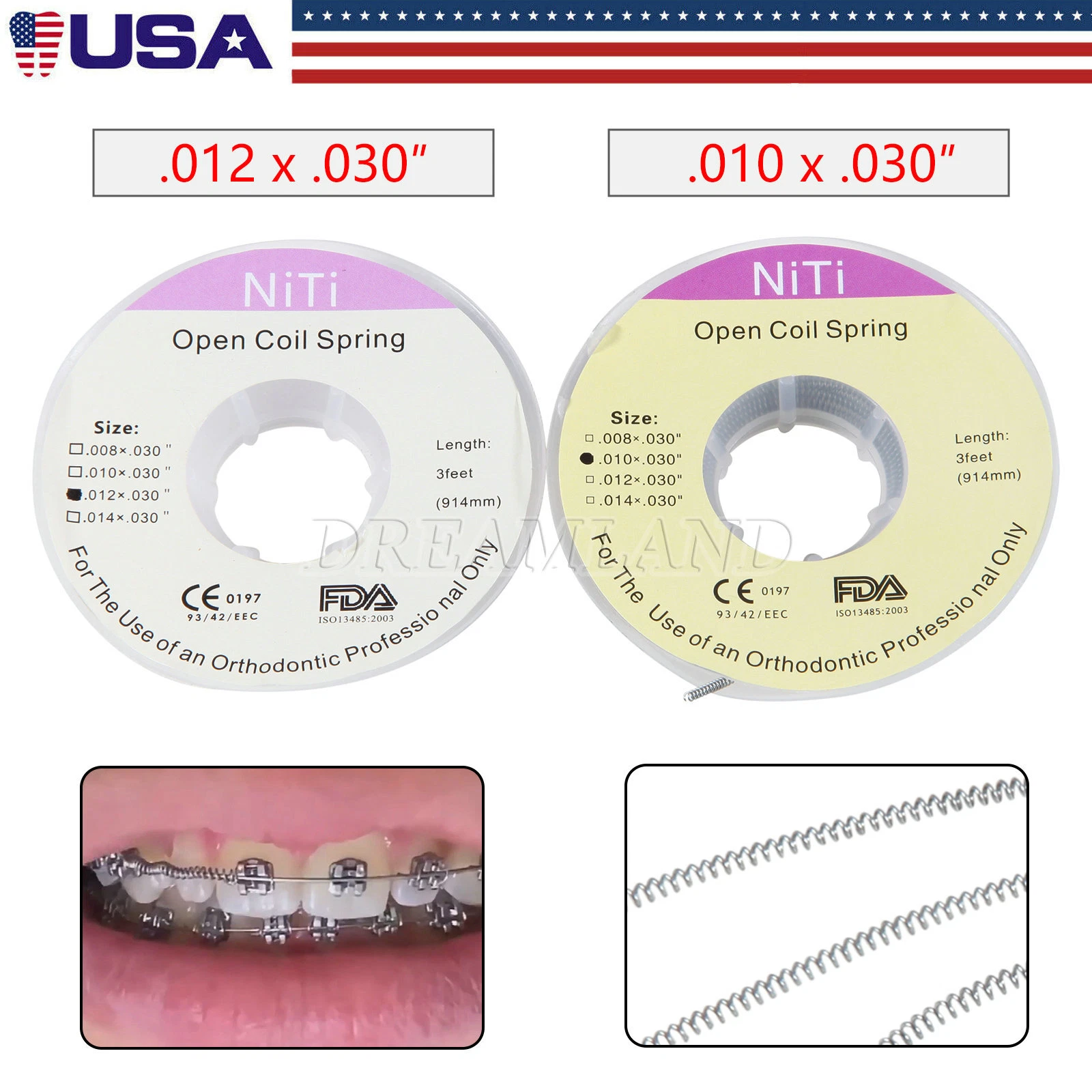 Dental Orthodontic Super Elastic Niti Round Arch Wire Ovoid Form