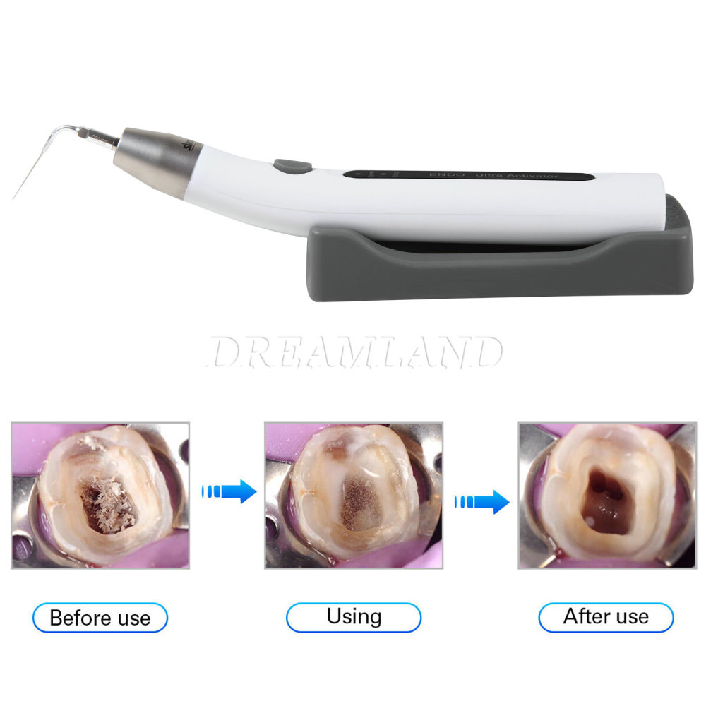 Ultrasonic Dental Endo Ultra Activator Irrigator Root Canal Scaling Tips 6 Tip