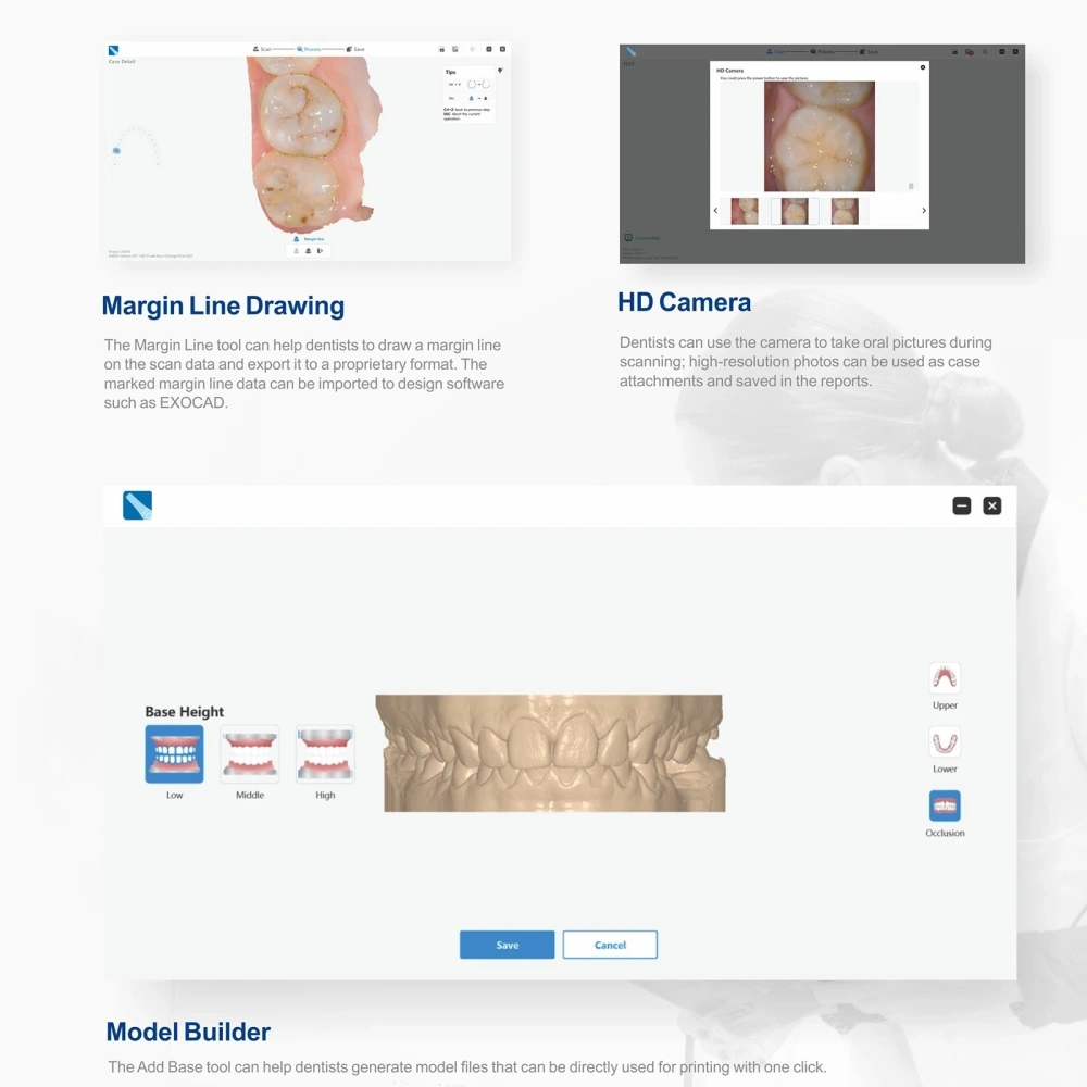 Dental Digital Impression Intra-Oral 3D Scanner