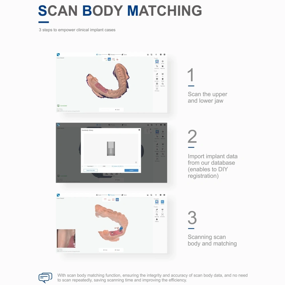 Dental Digital Impression Intra-Oral 3D Scanner
