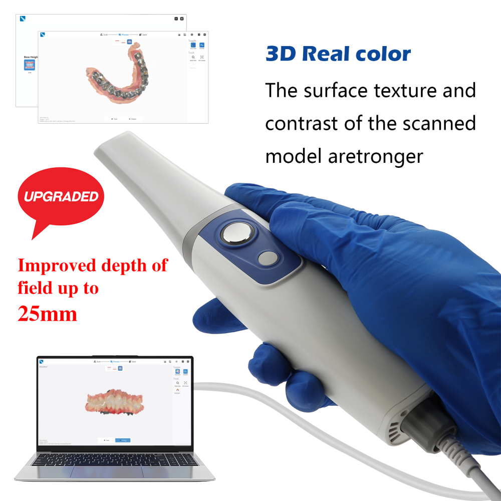 Dental Digital Impression Intra-Oral Scanner 3DS V5