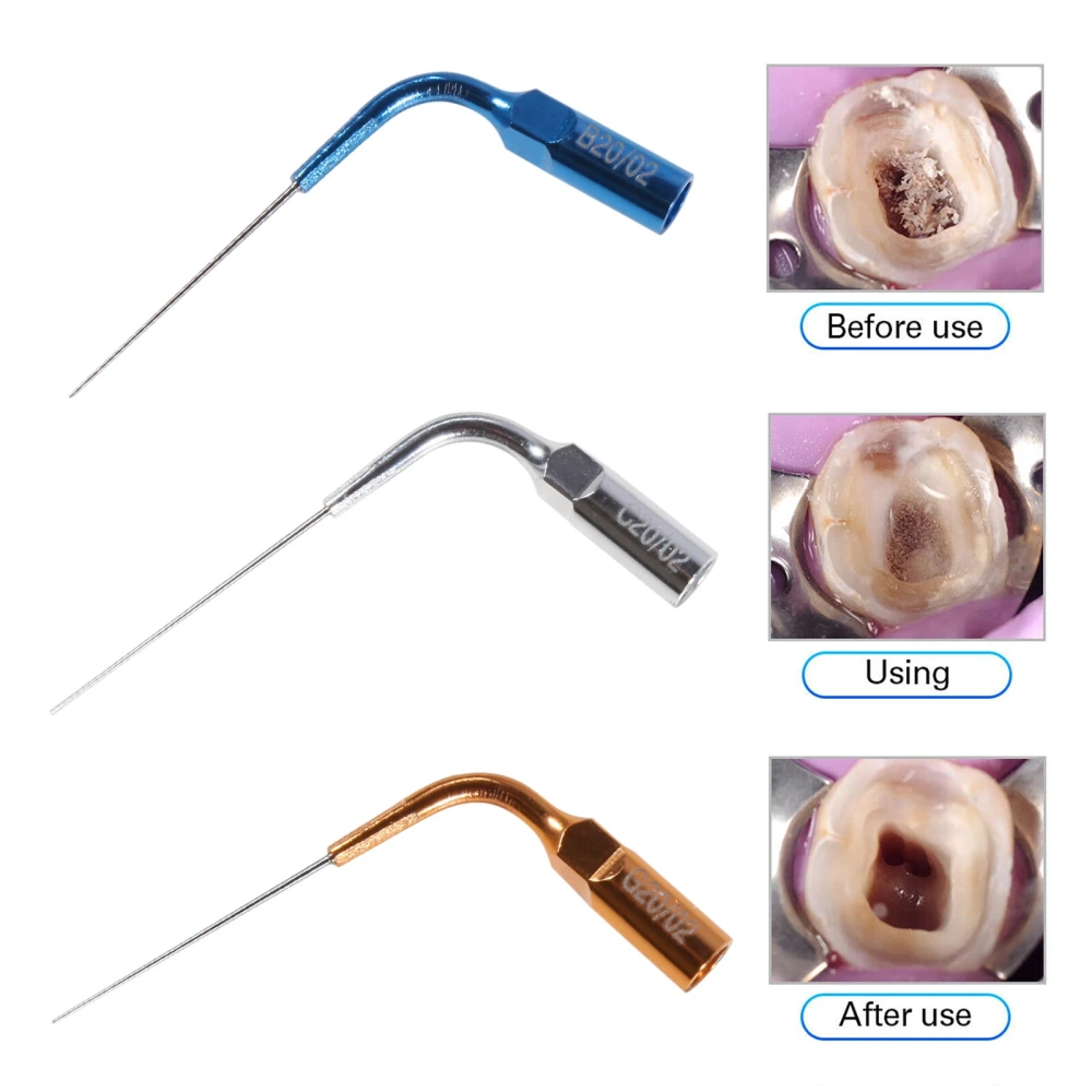Ultrasonic Dental Endo Ultra Activator Irrigator Root Canal Scaling Tips 6 Tip