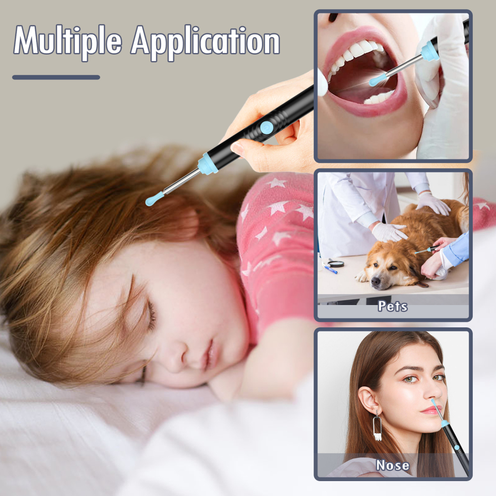 ear wax removal tool camera  ear cleaner with camera  ear wax removal tool  earwax removal kit with camera  Ears Wax Removal Kit with 1296P HD Ear Otoscope with 6 LED Lights Earwax Removal Tool for iPhone iPad & Android Smart Phones