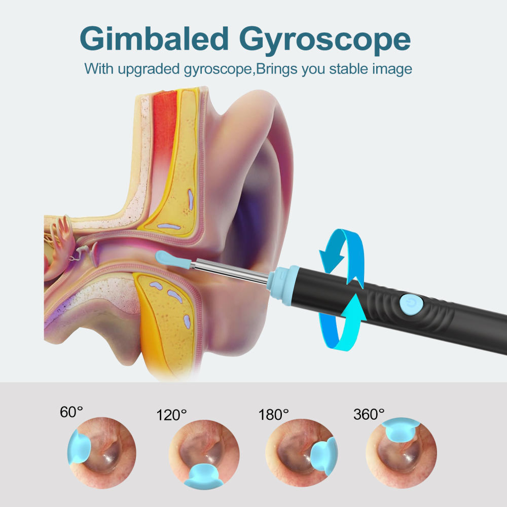 ear wax removal tool camera  ear cleaner with camera  ear wax removal tool  earwax removal kit with camera  Ears Wax Removal Kit with 1296P HD Ear Otoscope with 6 LED Lights Earwax Removal Tool for iPhone iPad & Android Smart Phones