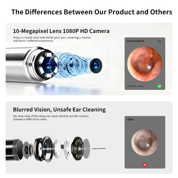 Sofbunny A03 Ear Wax Removal Camera with Screen - 1080P HD Ear Cleaner for Kids & Adults