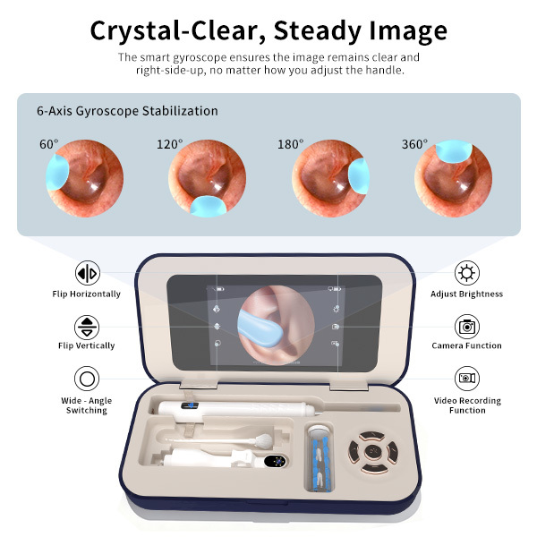 Sofbunny A03 Ear Wax Removal Camera with Screen - 1080P HD Ear Cleaner for Kids & Adults