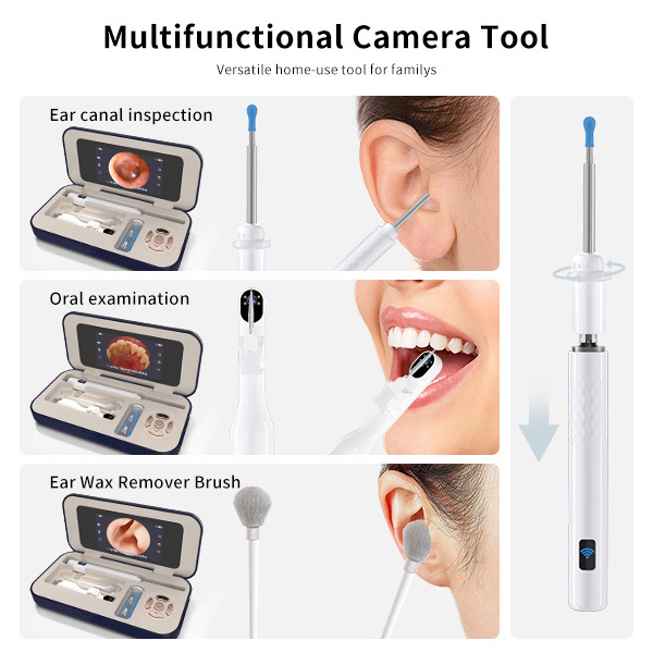 Sofbunny A03 Ear Wax Removal Camera with Screen - 1080P HD Ear Cleaner for Kids & Adults