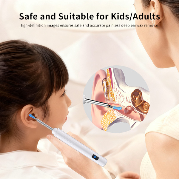 Sofbunny A03 Ear Wax Removal Camera with Screen - 1080P HD Ear Cleaner for Kids & Adults