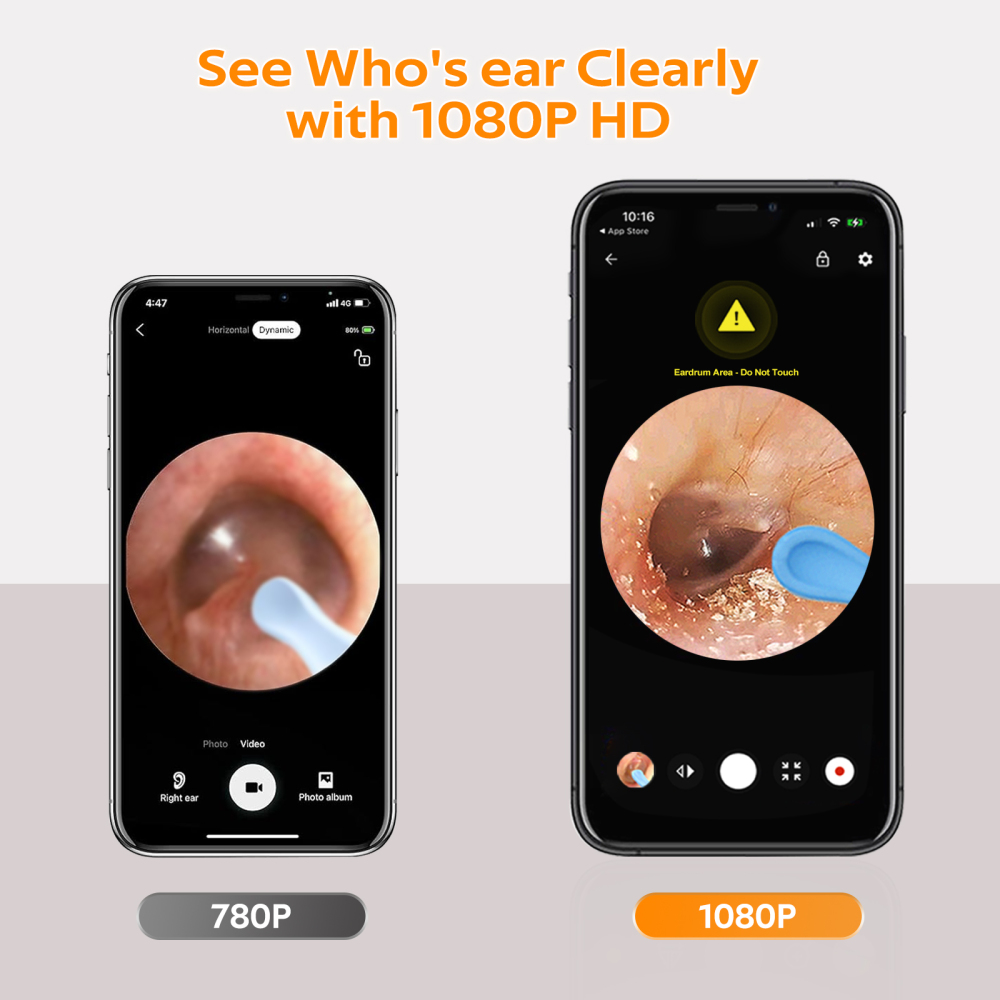Complete Ear Cleaning Kit: 1080P Camera with 6 LEDs & 8 Ear Picks, Wireless Ear Wax Remover for iPhone/iPad/Android, Safe for Home Use (Black)