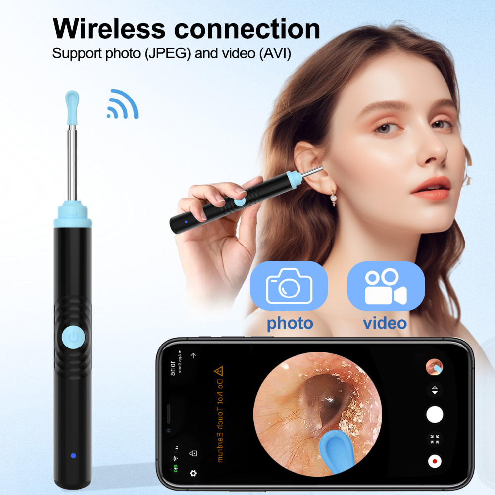 S2 Pro Wireless Ear Cleaner Camera Kit – 1296P HD Visual Ear Wax Removal Tool for Home Use