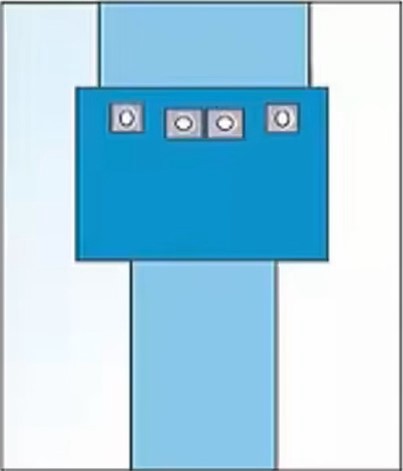 Femoral Angiography Drape