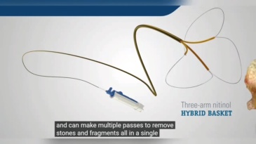 Disposable stone basket