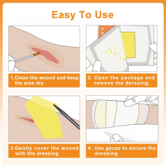 Xeroform gauze dressing